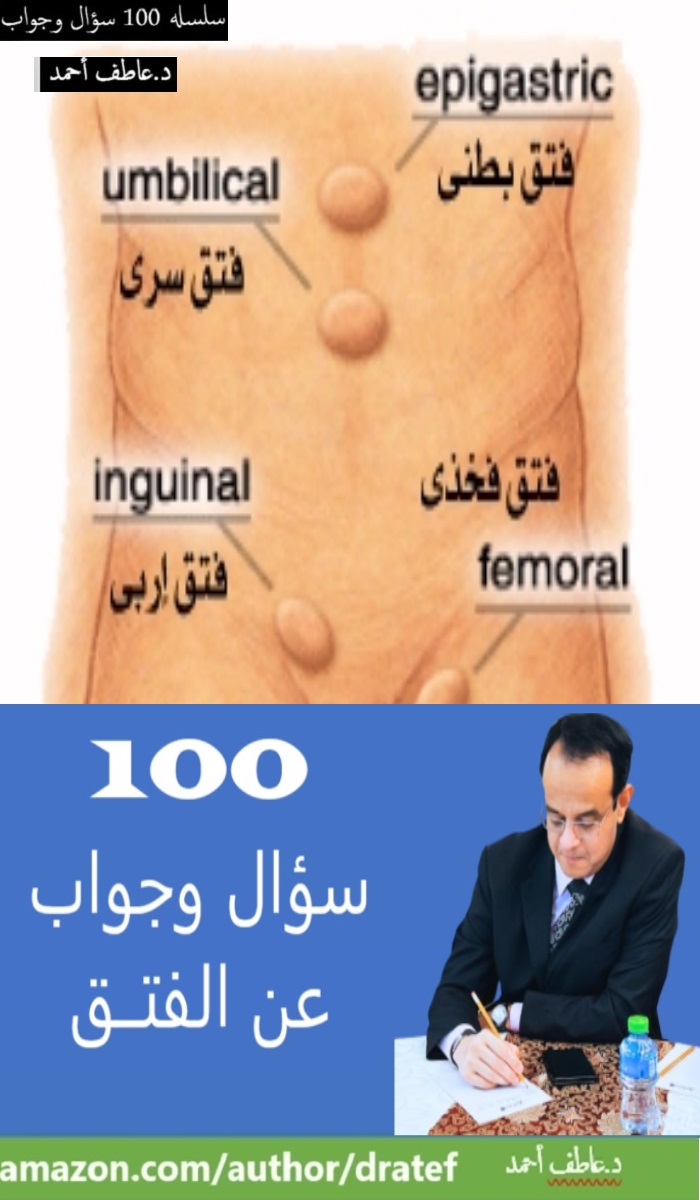 100 سؤال وجواب عن الإسعافات الأولية